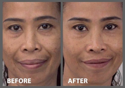 2 Minute Miracle Peptide+ Serum-2