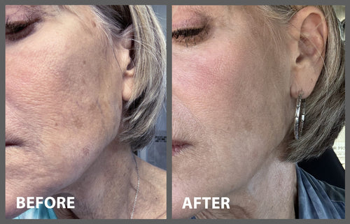2 Minute Miracle Peptide+ Serum-1
